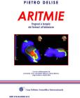 Aritmie. Prognosi e terapia dai farmaci all'ablazione
