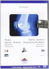 Protesi femoro rotulea-Patello femoral resurfacing prosthesis. DVD-ROM