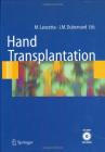 Hand transplantation. Con CD-ROM