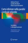 L arto inferiore nella paralisi cerebrale infantile. E-book